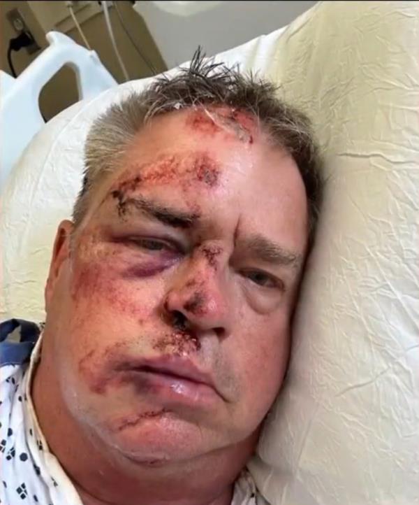 Harris was attacked from behind by at least one person as he walked past the crowd, who knocked the man unco<em></em>nscious and stole his wallet.