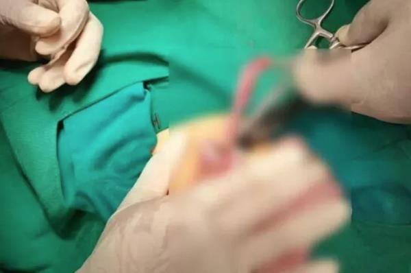 Surgeon 