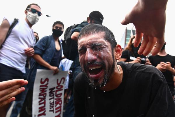 Aftermath of tear gas