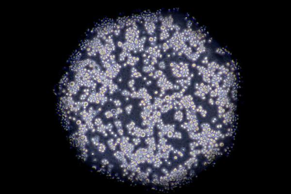 Cancer cells