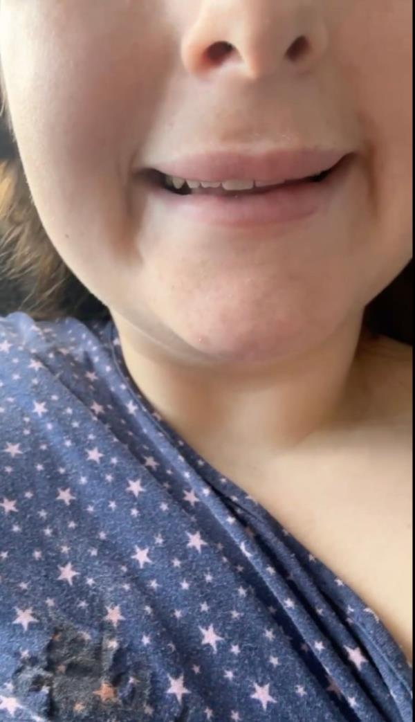 Photo of someone's crooked smile. 