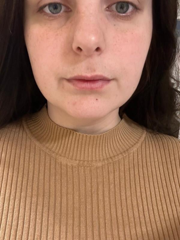 Photo of someone's lips. 