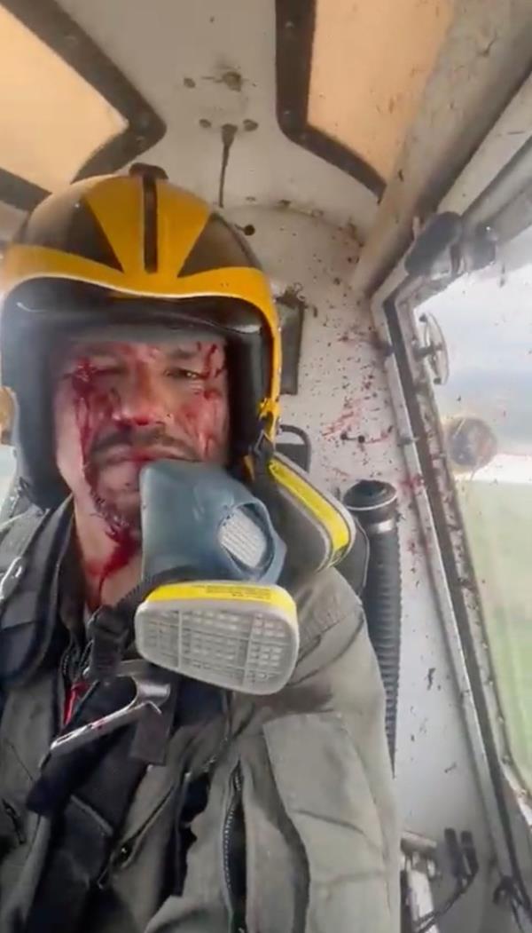 Bloodied Ecuadorian pilot Ariel Valiente