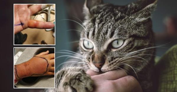 英国一名男子被野猫咬伤后感染了“未知”的疾病
