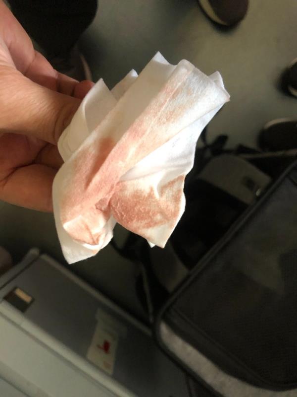 Bloody napkin on Air France flight