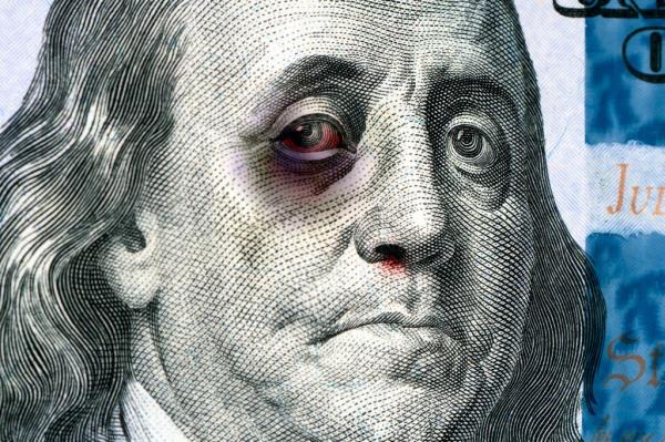 Benjamin Franklin on a 100 us bill with a black eye