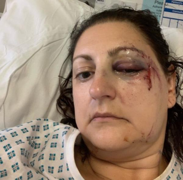 Four-year-old boy saves his mum's life after she tripped and knocked herself out