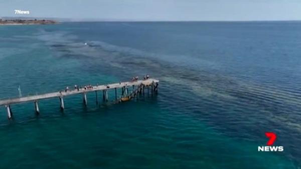 Aussie woman fighting for life after shark bites her on head 7 NEWS