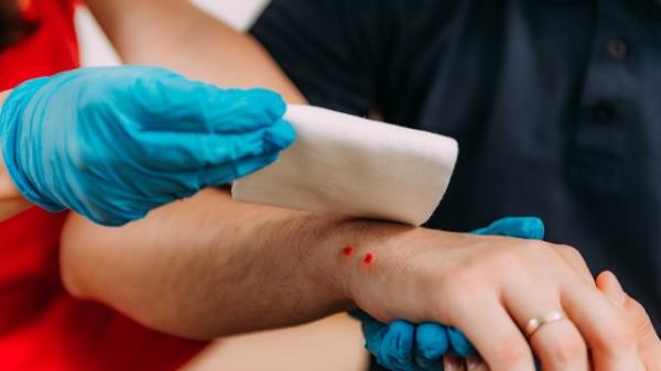 nurse putting gauze on a patient's hand with a snake bite