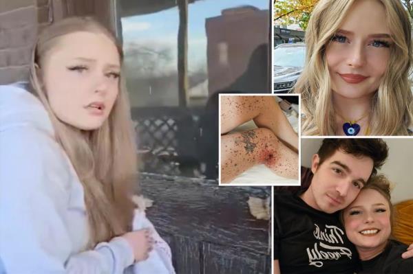 视频记录了youtube热门用户亨特·阿瓦隆的女友被前男友枪击后的瞬间