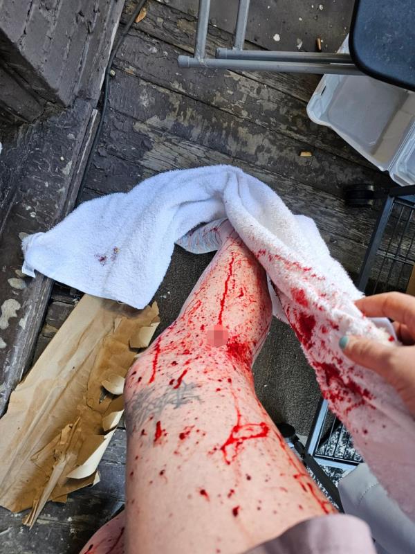 Peno was shot in the leg.